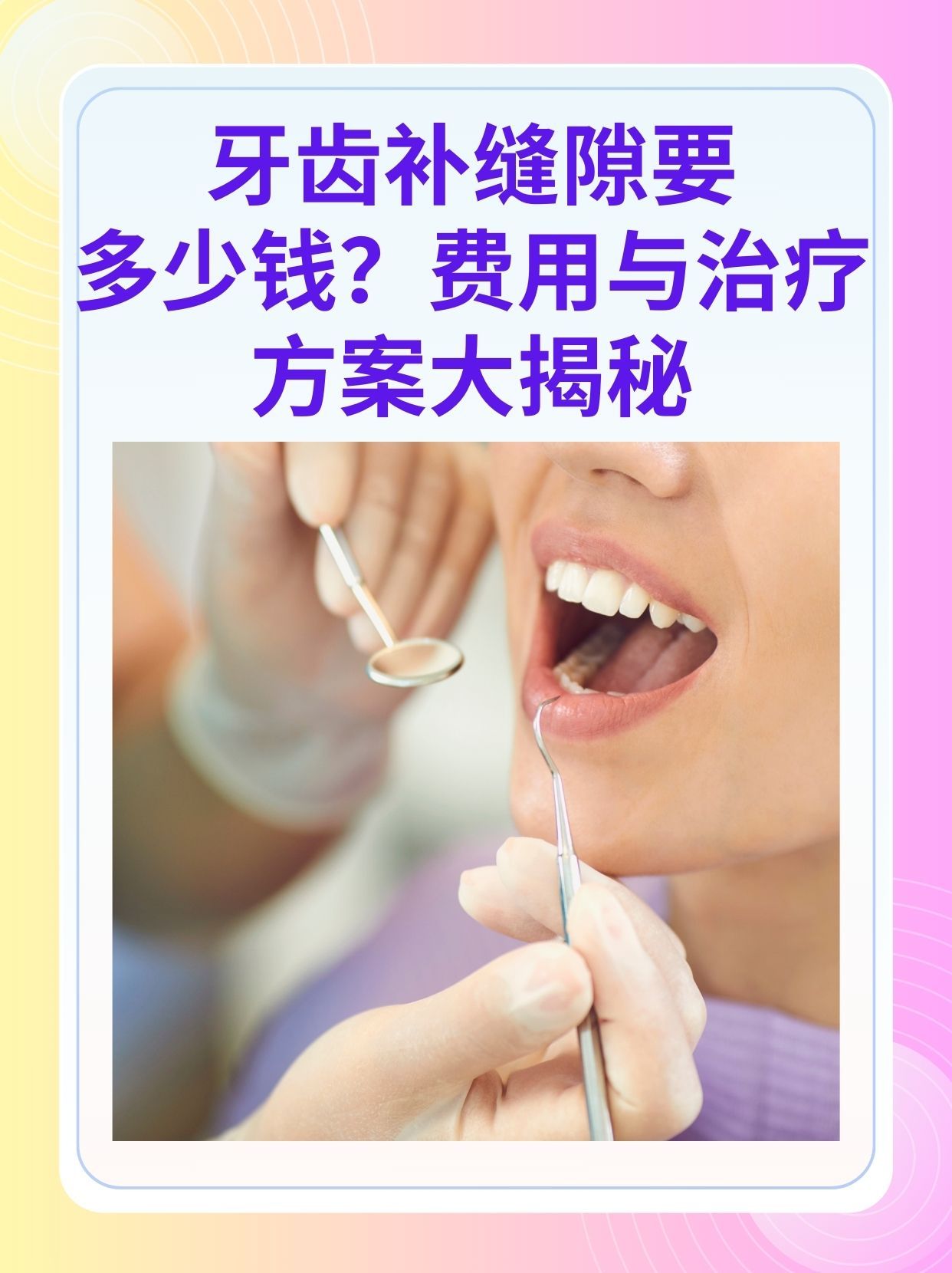 亳州补牙医保可以报销吗(补牙医保可以报销吗 哪些可以报销呢)